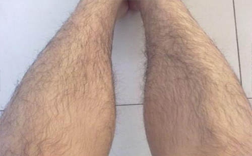 男生腿毛重原因 如何脫毛（方法）