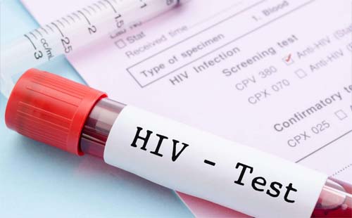武漢艾滋病hiv檢測(cè)醫(yī)院哪里最快