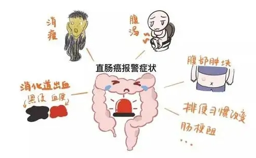 2022年武漢結(jié)直腸癌免費(fèi)篩查預(yù)約時(shí)間及方式 （附對(duì)象及項(xiàng)目?jī)?nèi)容）