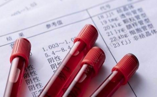 國(guó)慶北京出市旅游需要核酸檢測(cè)嗎